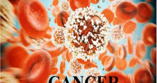 Learn How to Know Cancer Symptoms