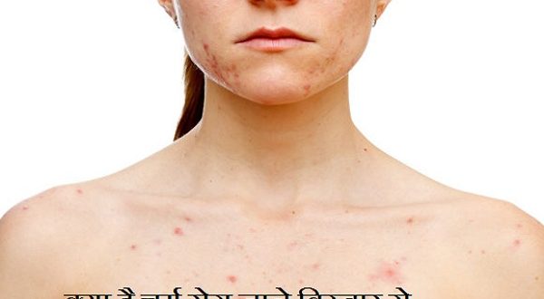 What is the skin disease in detail, and the easy ways to avoid it