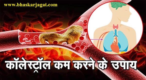Now you will get rid of the disease when he will control his cholesterol level from these household items.