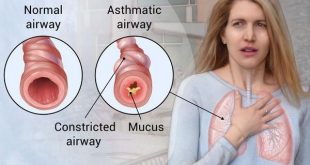 If you have a terrible disease like asthma then adopt this easy home remedy